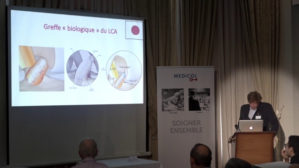 Chirurgie m&eacute;niscale et ligamentaire: quoi de neuf en 2019?