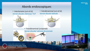 Le renouveau de l&rsquo;endoscopie rachidienne