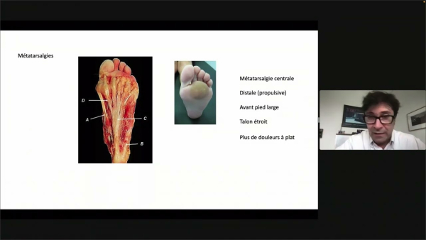 Bri&egrave;vet&eacute; des gastrocn&eacute;miens