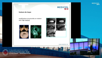 Facteurs de risque et diagnostic diff&eacute;renciel